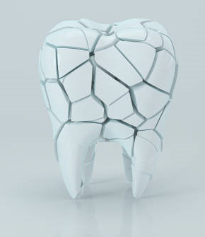 A digital tooth is cracked into several pieces
